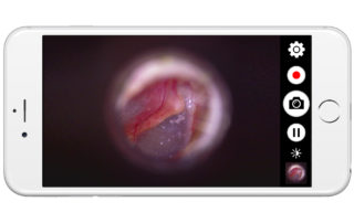firefly otoscope price