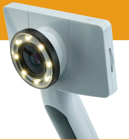 RCS-100 General Examination Camera System - Bundle Includes Camera, Lenses (Derm, General, Oto), Integrated Software and Disposable Oto Specula (Pediatric & Adult - 1000ea)