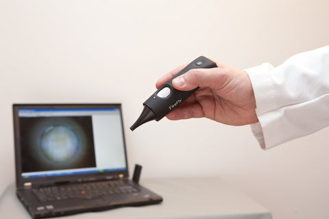Firefly DE550 Wireless Otoscope