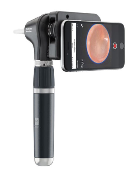 71-XM3LXE, Welch Allyn MacroView Plus Otoscope Kit