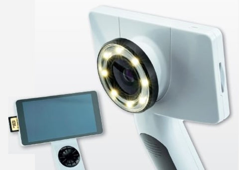 RCS-100 General Examination Camera System - Bundle Includes Camera, Lenses (Derm, General, Oto), Integrated Software and Disposable Oto Specula (Pediatric & Adult - 1000ea)
