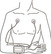 BodiMetrics ECG Lead Wires for VitalsRx