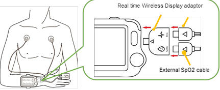 BodiMetrics VitalsRx Mini-Adapter for ECG & SpO2
