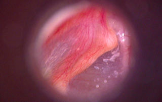Firefly DE500 USB Otoscope