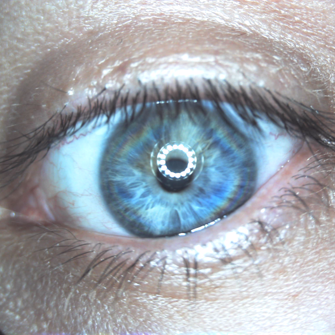 Firefly DE605 USB General Examination Camera Iris Examination