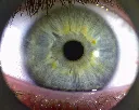 Eye1-.webp