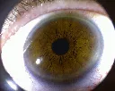 Eye4.webp