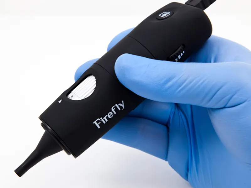[FFLY-DE500] Firefly DE500 USB Digital Otoscope